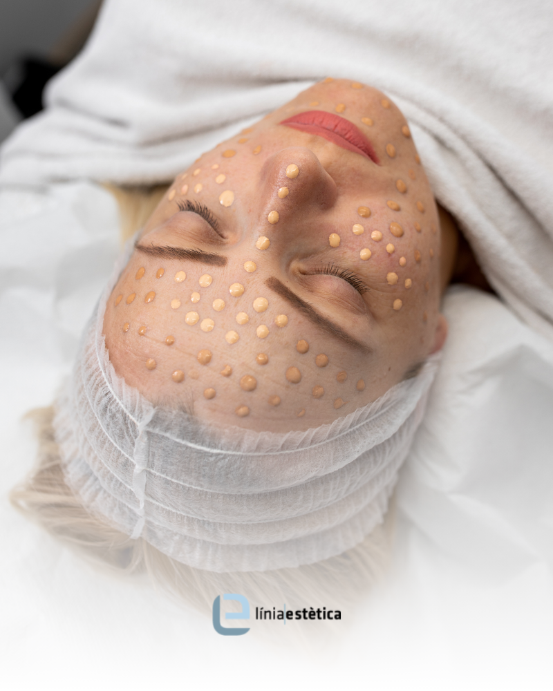 Estética decorativa