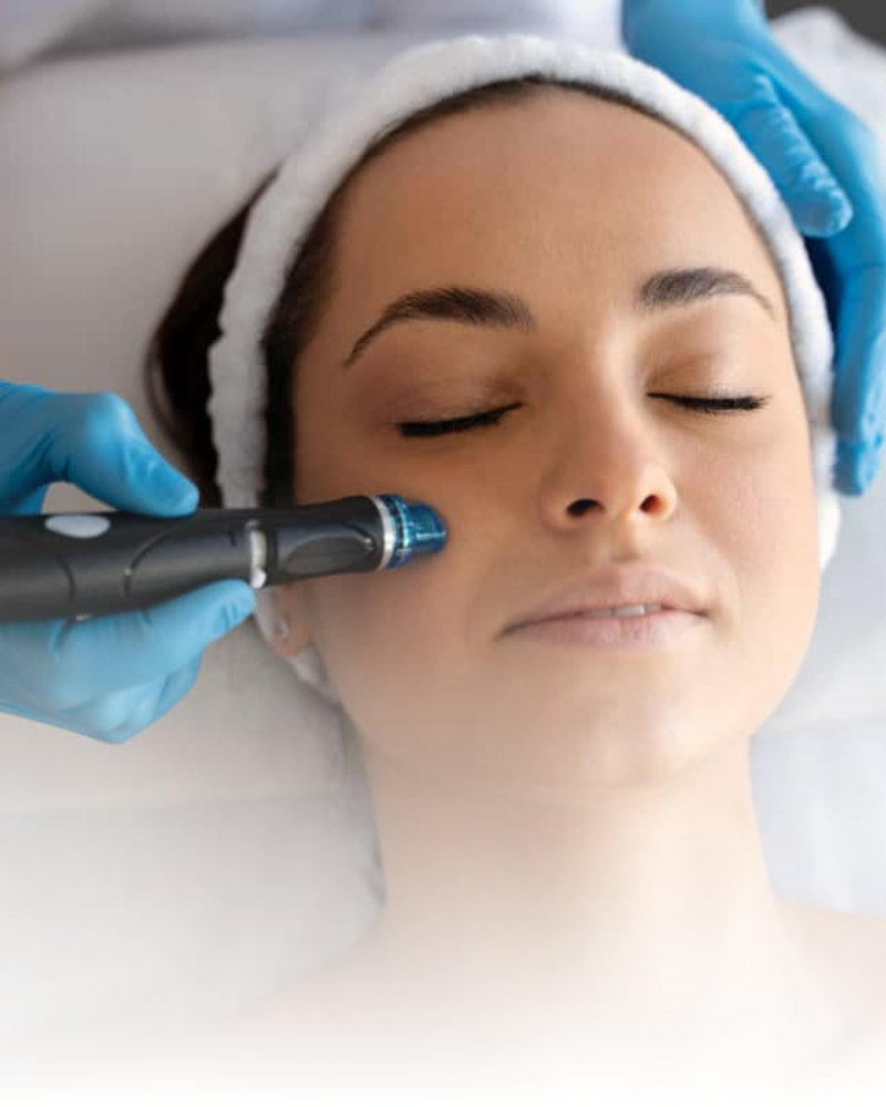 Higiene facial, tratamientos acné, marcas acné, cicatrices