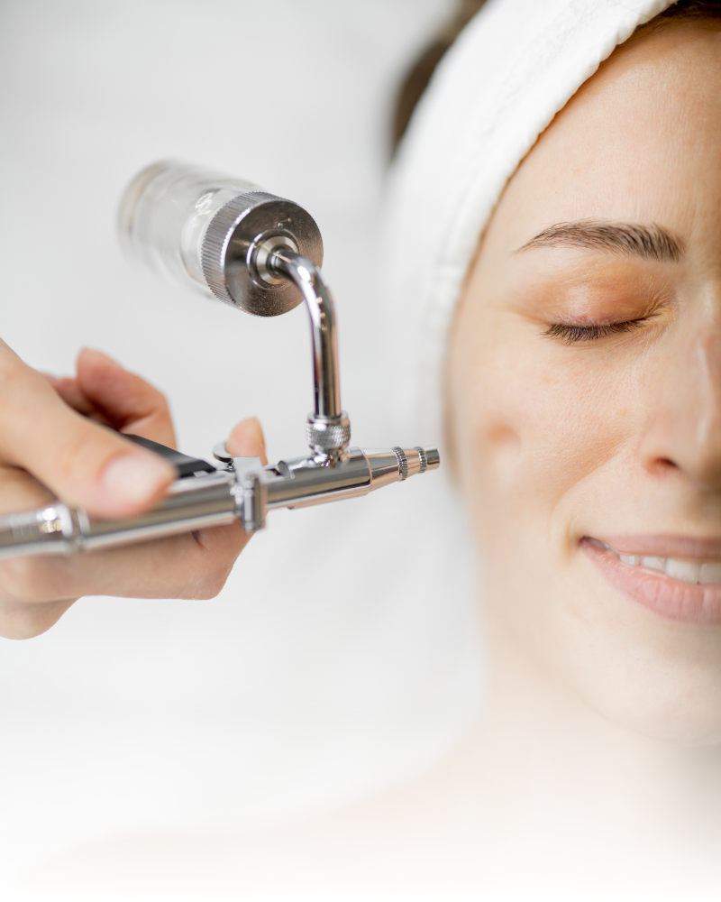 Higiene facial, tratamientos acné, marcas acné, cicatrices