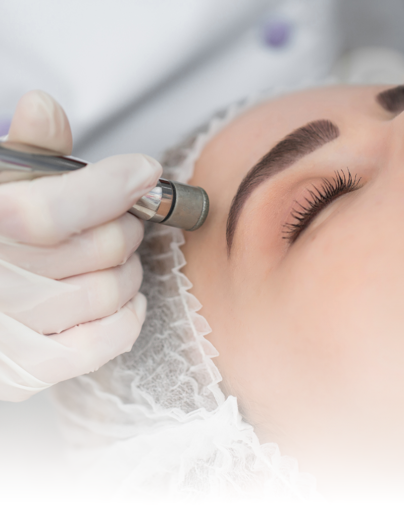 Higiene facial, tratamientos acné, marcas acné, cicatrices