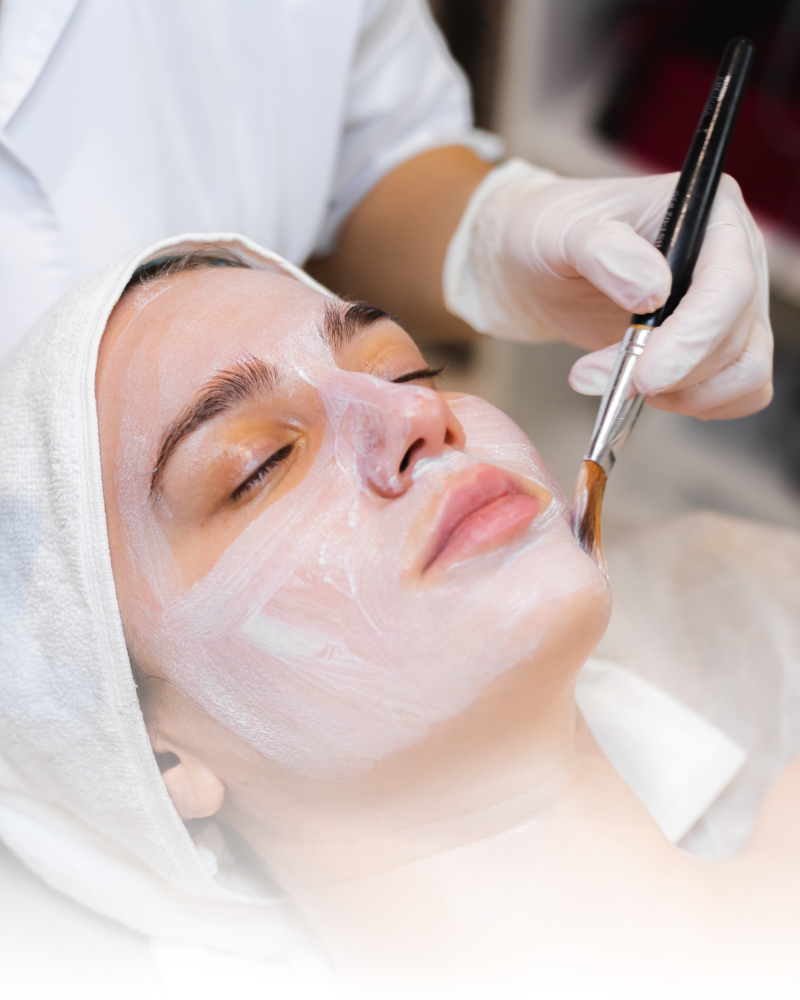 Higiene facial, tratamientos acné, marcas acné, cicatrices