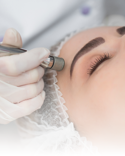 Higiene facial, tratamientos acné, marcas acné, cicatrices